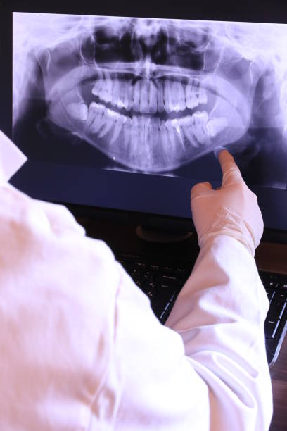 Best Emergency Dentist for Lost Fillings or Crowns in Sequim, WA